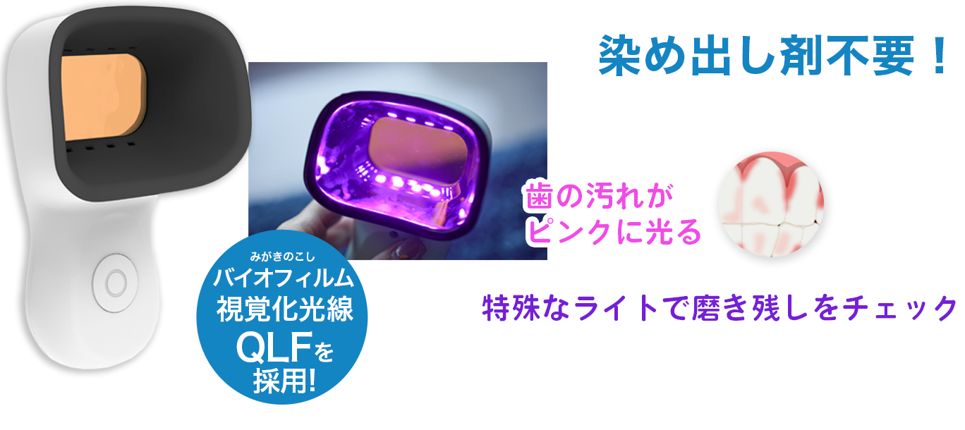 特殊なライトで磨き残しをチェック